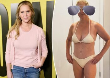 Amy Schumer shows off C-section scar in tiny bikini, boasts that she’s a ‘warrior’