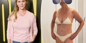 Amy Schumer shows off C-section scar in tiny bikini, boasts that she’s a ‘warrior’