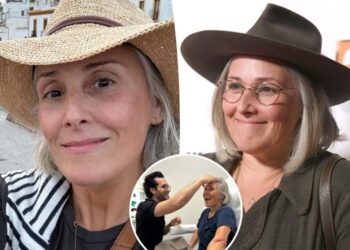 Ricki Lake shares unfiltered before-and-after photos to mark 2 years since facelift: ‘I’m so grateful’