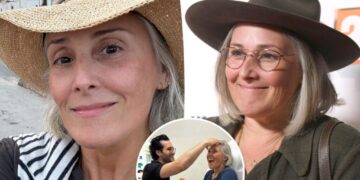 Ricki Lake shares unfiltered before-and-after photos to mark 2 years since facelift: ‘I’m so grateful’