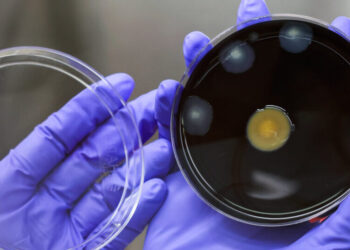 Second Patient Dies in Outbreak of Legionnaires’ Disease in Manhattan