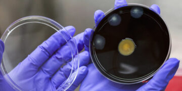 Second Patient Dies in Outbreak of Legionnaires’ Disease in Manhattan