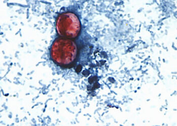 Cyclospora Spreads Through Human Feces. How Did It Get Into Our Food Supply?