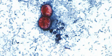 Cyclospora Spreads Through Human Feces. How Did It Get Into Our Food Supply?