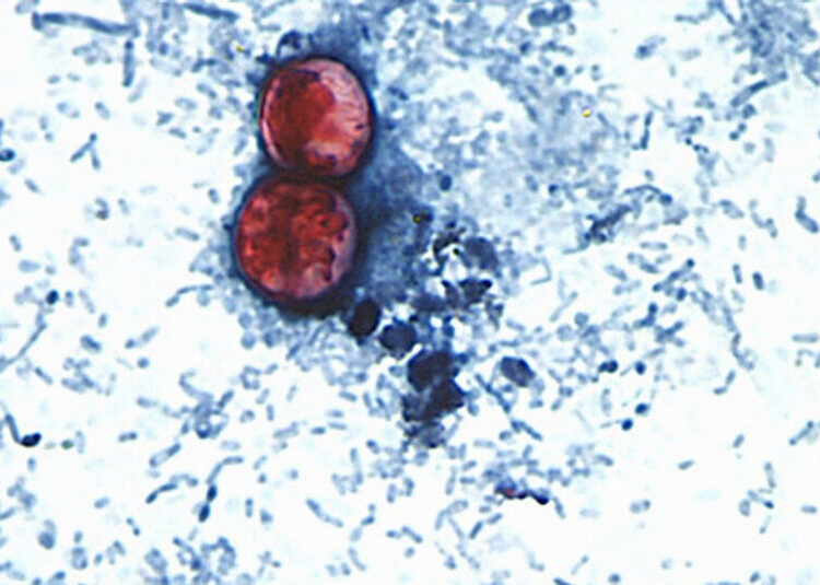 Cyclospora Spreads Through Human Feces. How Did It Get Into Our Food Supply?