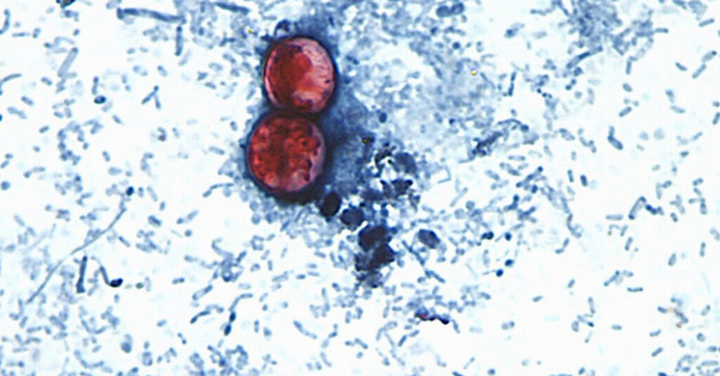 Cyclospora Spreads Through Human Feces. How Did It Get Into Our Food Supply?