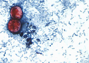 What the Cyclospora Outbreak Reveals