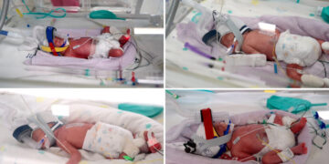 Australian Woman Gives Birth to ‘Miracle’ Identical Quadruplets