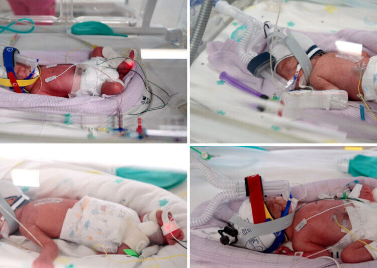 Australian Woman Gives Birth to ‘Miracle’ Identical Quadruplets