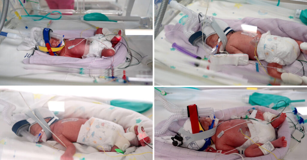 Australian Woman Gives Birth to ‘Miracle’ Identical Quadruplets
