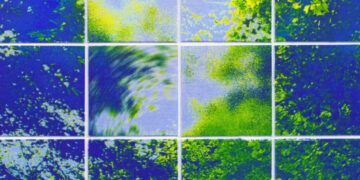 Extreme Dizziness, No Headache: The Migraine Many Doctors Miss