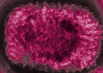 ‘This Is Very Strange’: Ancient Smallpox May Have Been Less Deadly