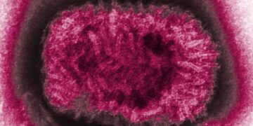 ‘This Is Very Strange’: Ancient Smallpox May Have Been Less Deadly