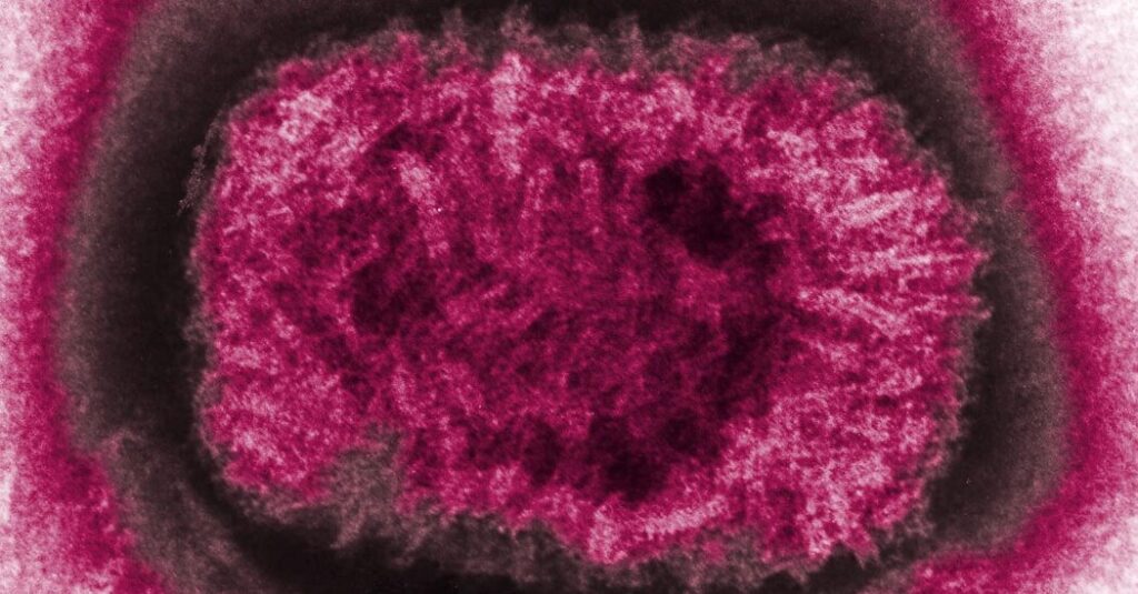 ‘This Is Very Strange’: Ancient Smallpox May Have Been Less Deadly