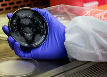 Legionnaires’ Outbreak on Upper East Side Is Over, N.Y.C. Officials Say