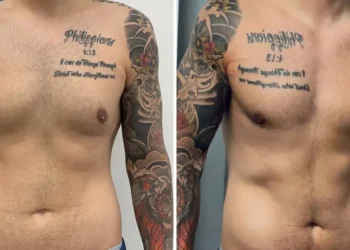 Men get cosmetic surgery, too. I spent $14,000 on plastic surgery, and I don’t regret it.
