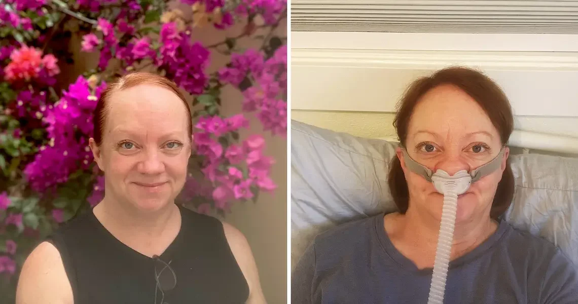 I thought I was exhausted by being a single, middle-aged parent. I learned sleep apnea was the culprit.