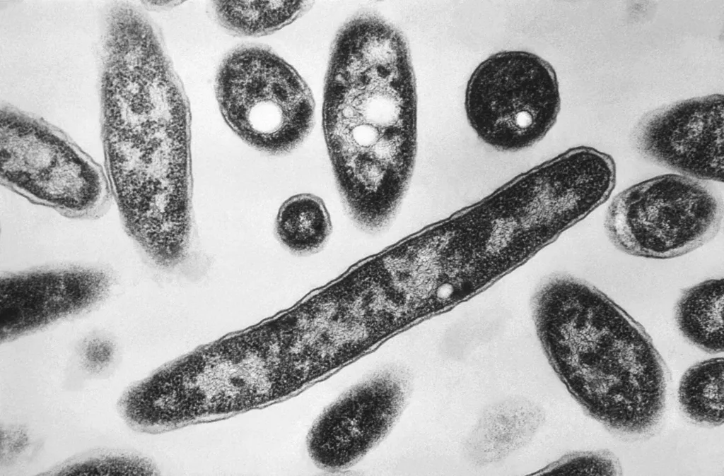 Black and white microscopic image showing several Legionella bacteria, some oblong and some round.