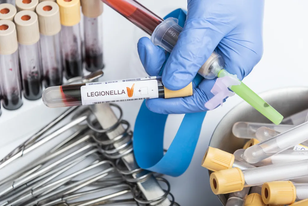 A hand in a blue glove holding a blood sample test tube labeled
