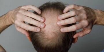 GLP-1 Drugs Like Ozempic May Be Linked to Hair Loss, New Study Finds