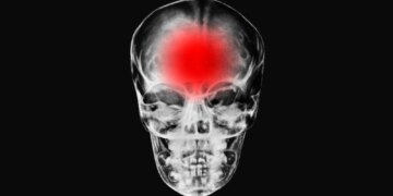 Modern Life May Be Overloading the Human Brain, New Research Suggests