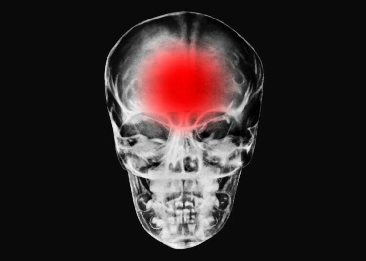 Modern Life May Be Overloading the Human Brain, New Research Suggests
