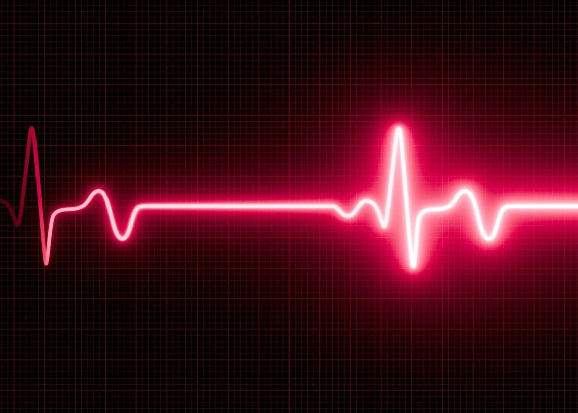 This Woman Nearly Died After Her Daughter’s Wedding Triggered ‘Happy Heart Syndrome’