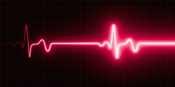 This Woman Nearly Died After Her Daughter’s Wedding Triggered ‘Happy Heart Syndrome’