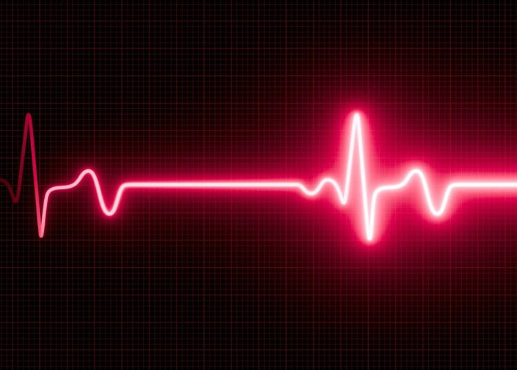 This Woman Nearly Died After Her Daughter’s Wedding Triggered ‘Happy Heart Syndrome’