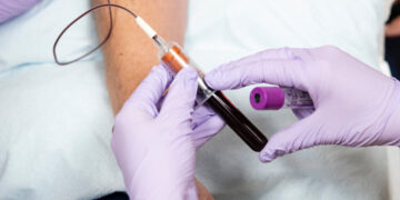 What to Know About the Powerful New Cholesterol Pill