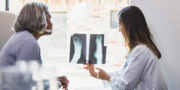 Concerned you have bone thinning? Here’s what experts recommend.