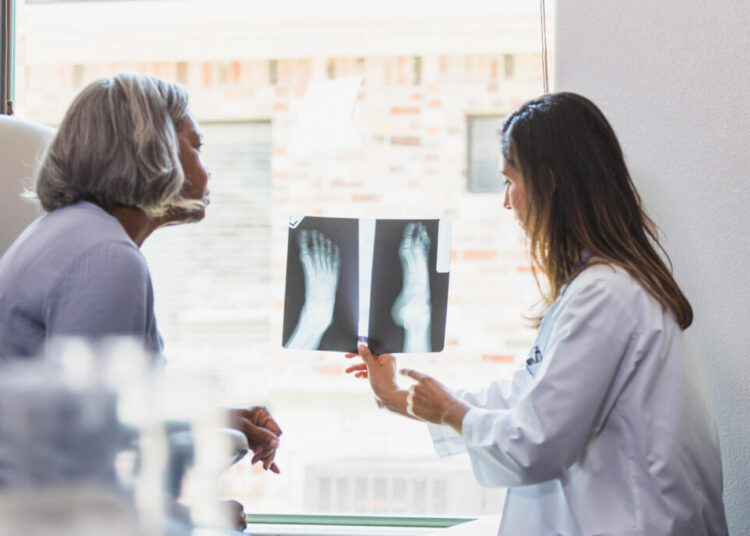 Concerned you have bone thinning? Here’s what experts recommend.