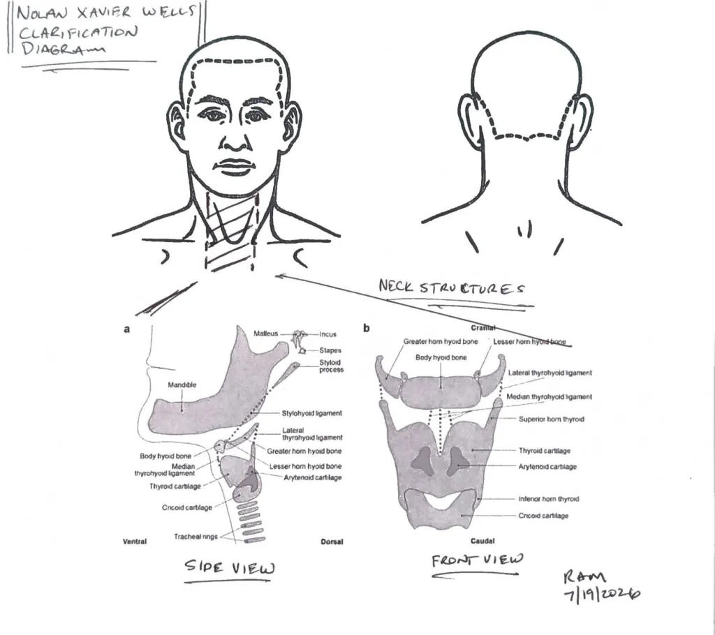 Illustration of Nolan Xavier Wells' neck structures, with a front and side view diagramming the bones and ligaments.