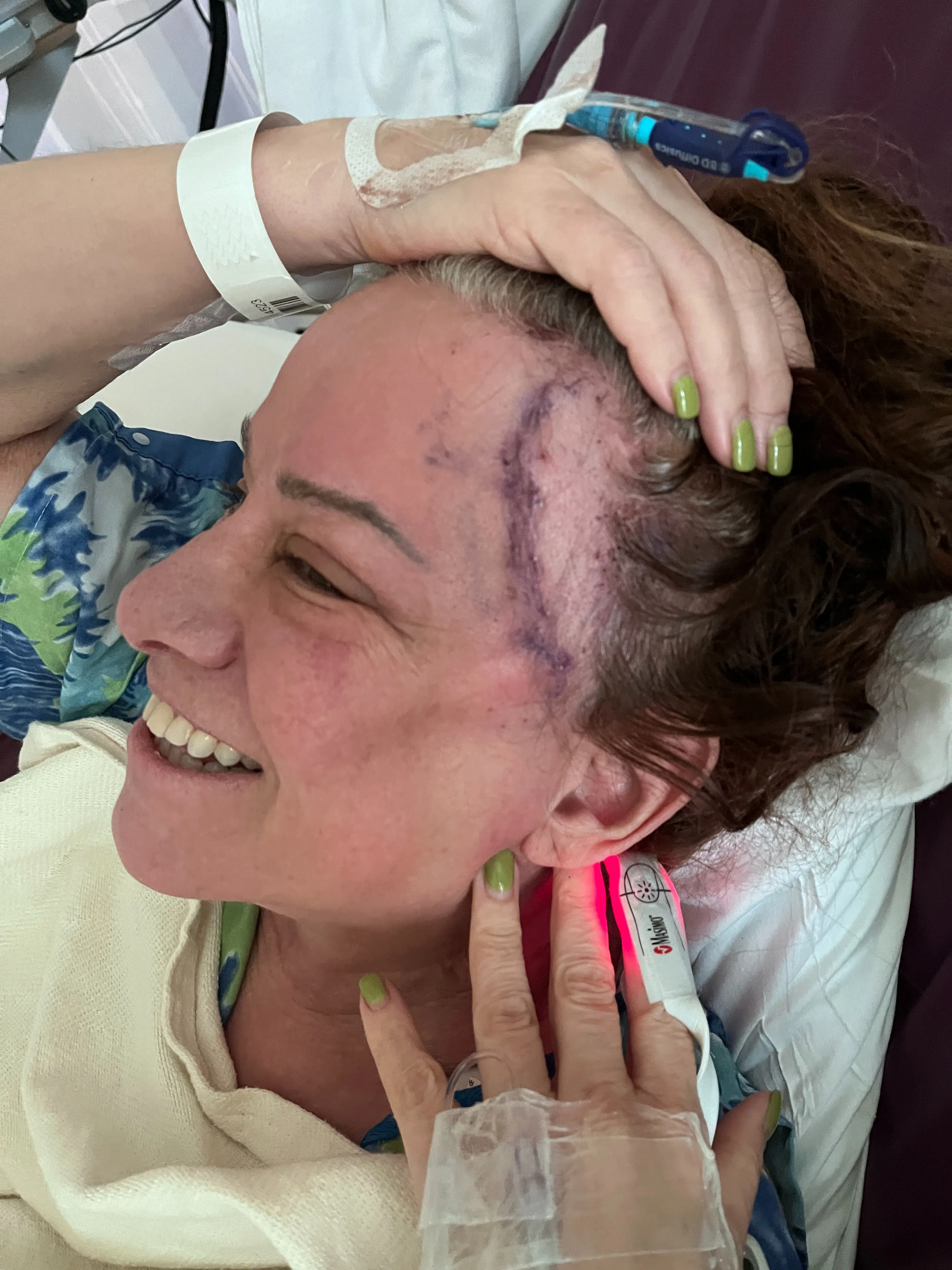 Finch had appeared to be in good spirits in photos shared by her loved ones of the revered rocker showing off her surgery scars from her hospital bed.