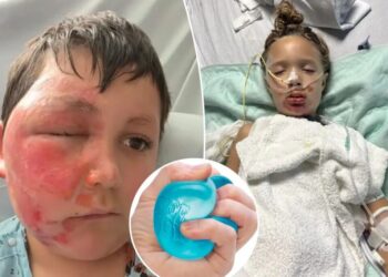 Doctors issue warning over massively popular toy that’s hospitalizing children with excruciating injuries