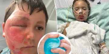Doctors issue warning over massively popular toy that’s hospitalizing children with excruciating injuries