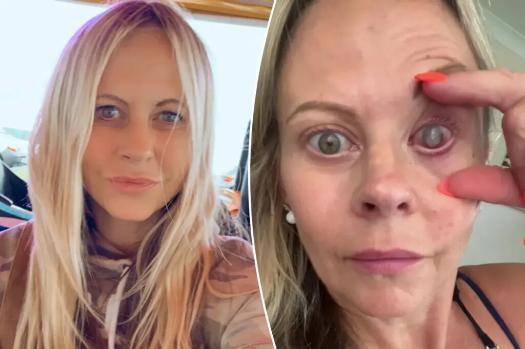 My eye had to be sewn shut after a parasite ate my cornea — the crucial mistake I made