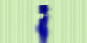 Postpartum Psychosis Is Rising. We Are Not Ready.