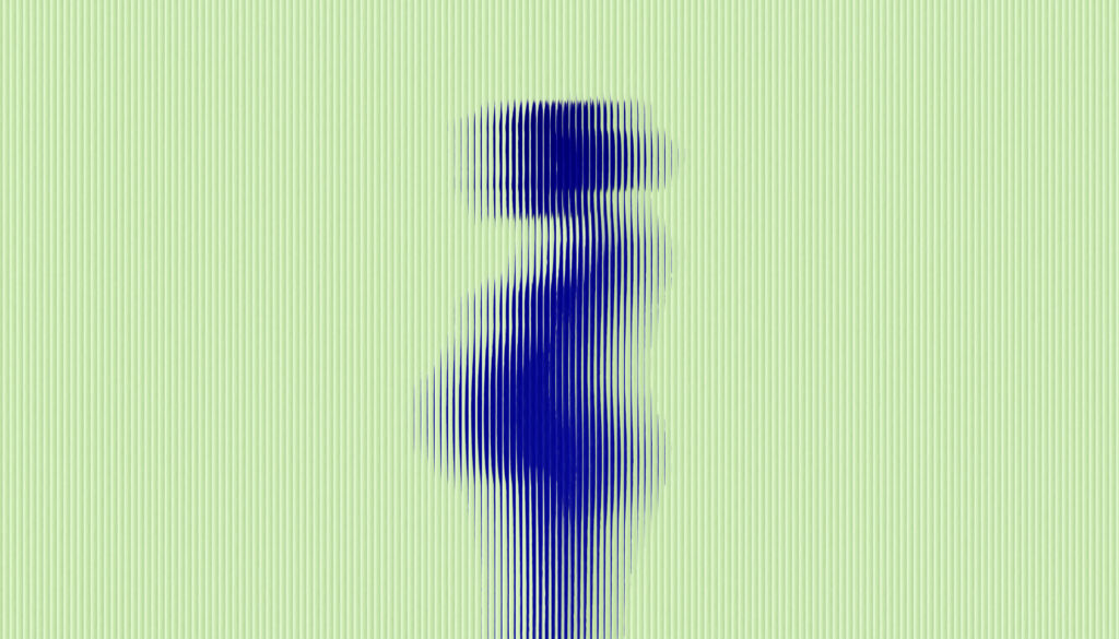 Postpartum Psychosis Is Rising. We Are Not Ready.