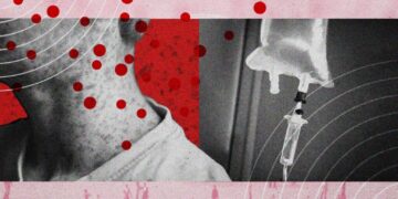Measles Is Becoming So Common That Treatments May Soon Be Needed