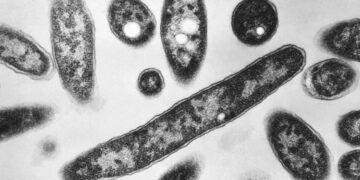 Second death reported in Legionnaires’ disease outbreak in New York City