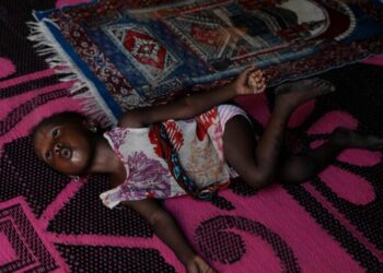 Another effect of the Iran war: Nigerian children suffer as malnutrition and poverty surge