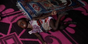 Another effect of the Iran war: Nigerian children suffer as malnutrition and poverty surge