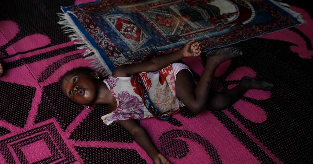 Another effect of the Iran war: Nigerian children suffer as malnutrition and poverty surge