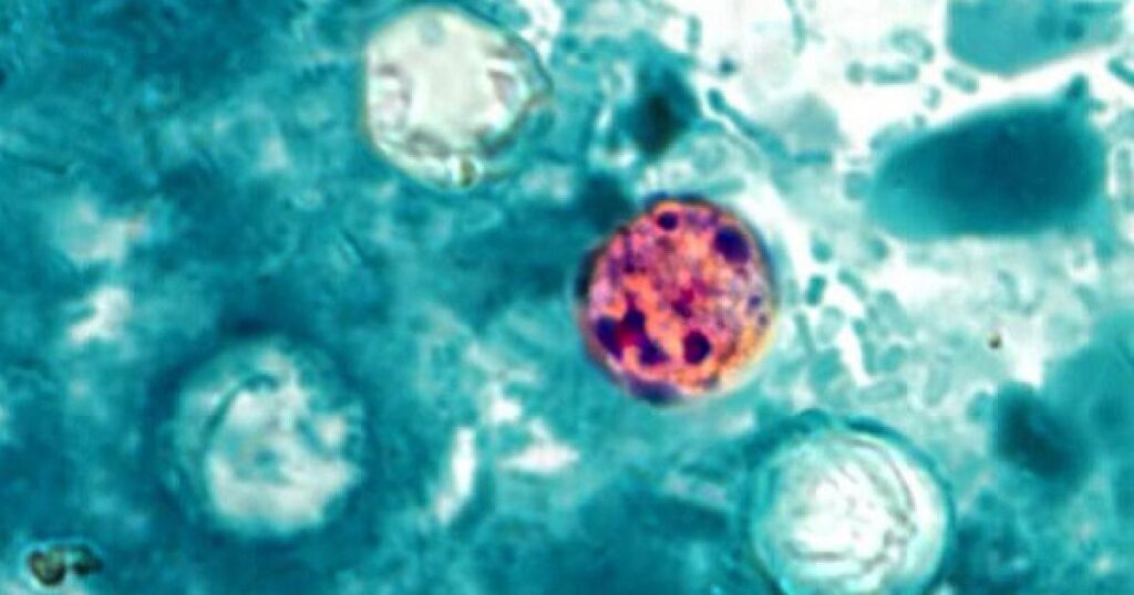 Diarrhea-causing cyclosporiasis exceeds 1,000 cases in U.S. What Californians should know