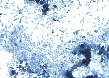 Outbreak of diarrhea-causing parasite grows to more than 1,000 cases