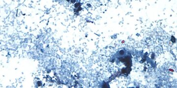 Outbreak of diarrhea-causing parasite grows to more than 1,000 cases