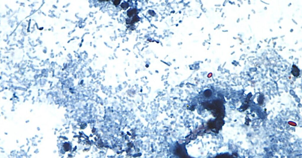 Outbreak of diarrhea-causing parasite grows to more than 1,000 cases