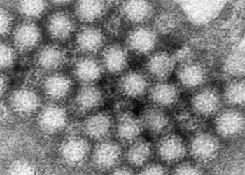 Norovirus outbreak on cruise ship from California sickens more than 100 passengers