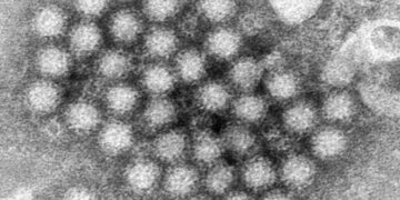 Norovirus outbreak on cruise ship from California sickens more than 100 passengers